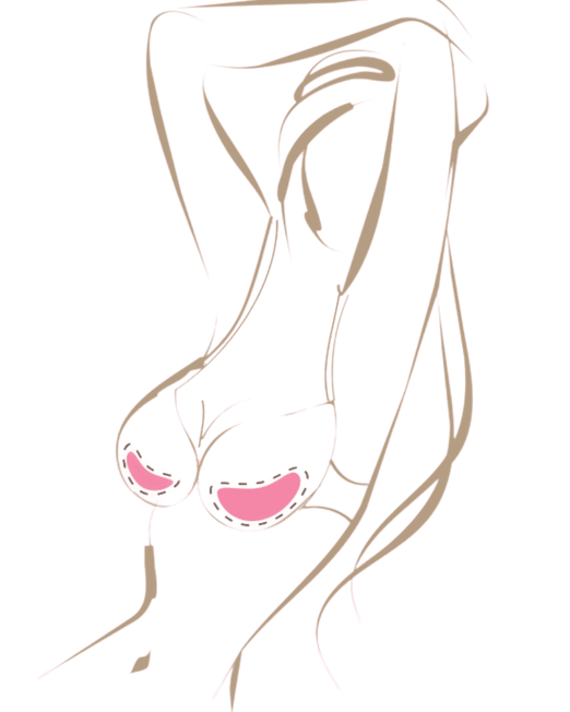 Breast Enhancer Bra Inserts Special Offer Duo Pack.