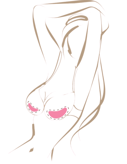 Breast Enhancer Bra Inserts Special Offer Duo Pack.